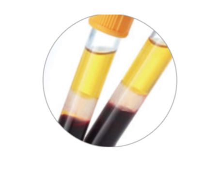親凝固の管の製造者のための医学の使い捨て可能な血のコレクションの管