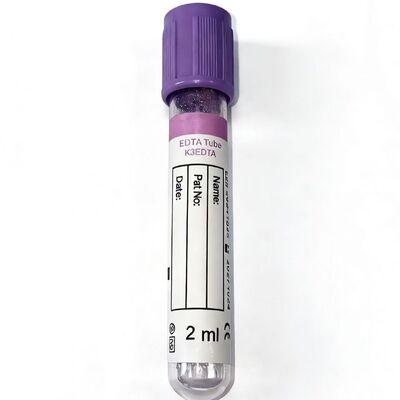 全血 EDTA 管: 血学 と 分子 検査 の 完全性 に 欠かせない